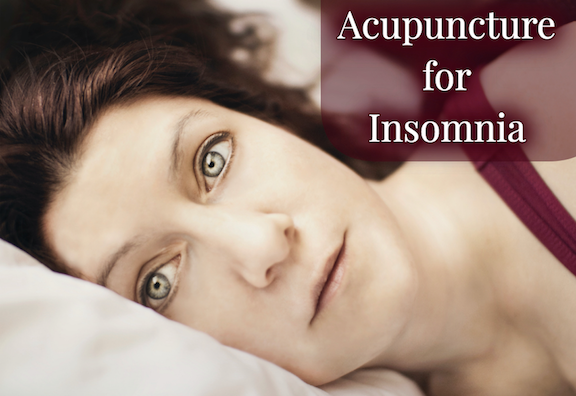 Fascinating Research on Acupuncture Treatment for Insomnia