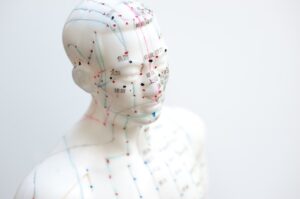 “#1 Guide” - Acupuncture for Bi Syndrome in the Meridians - 2 Acupuncture CEUs/PDAs