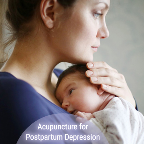 Acupuncture Can Help With Postpartum Depression