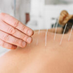 "12 Tips" Acupuncture for Sports Injuries - 5 Acupuncture CEUs/PDAs