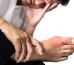 “*Acupuncture for Gout*” - What You Must Know - 6 Acupuncture CEUs/PDAs