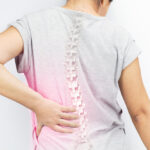“#1 - 10 Lessons” - Scoliosis & Western Medicine - 7 Acupuncture CEUs/PDAs