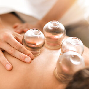 “#01 – 4 Lessons” – Cupping for Pain Management – 4 Acupuncture CEUs
