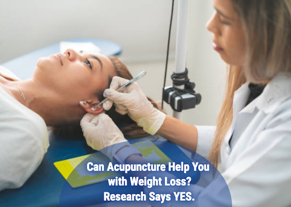 Can Acupuncture Help You with Weight Loss? Research Says YES