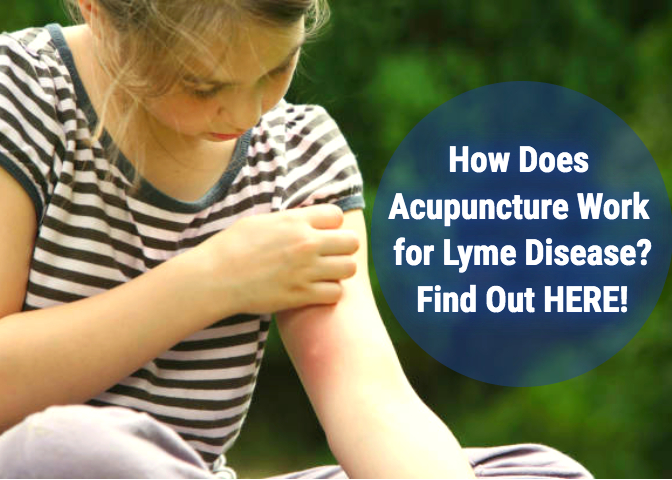 How Does Acupuncture Work for Lyme Disease? Find Out HERE!