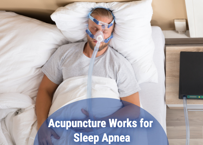 Acupuncture for Sleep Apnea