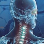 8 Things You Need to Know About CNS Tumors - 16 Acupuncture CEUs/PDAs