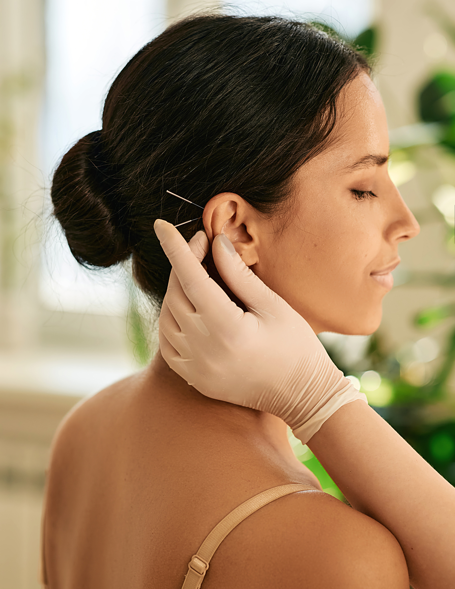 Auricular Acupuncture Insights