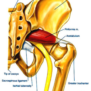 5 CEUs Sciatica Anatomy & Physiology - Florida Only